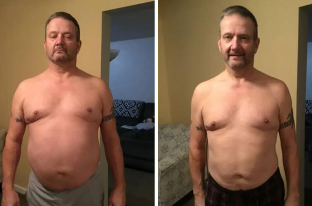 Todd before and after getting weight loss treatment