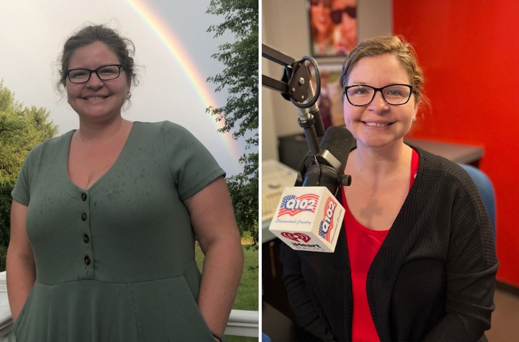 Lori from Shenandoah Country Q102 before and after weight loss treatment