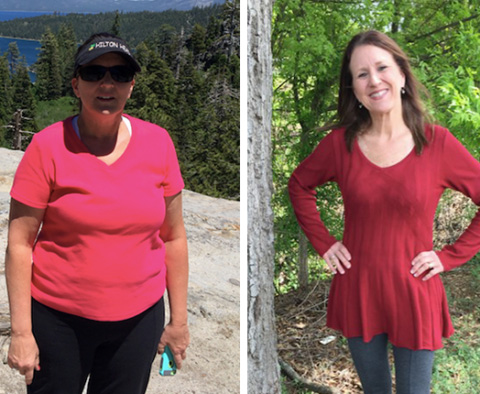 Janice before and after weight loss treatment